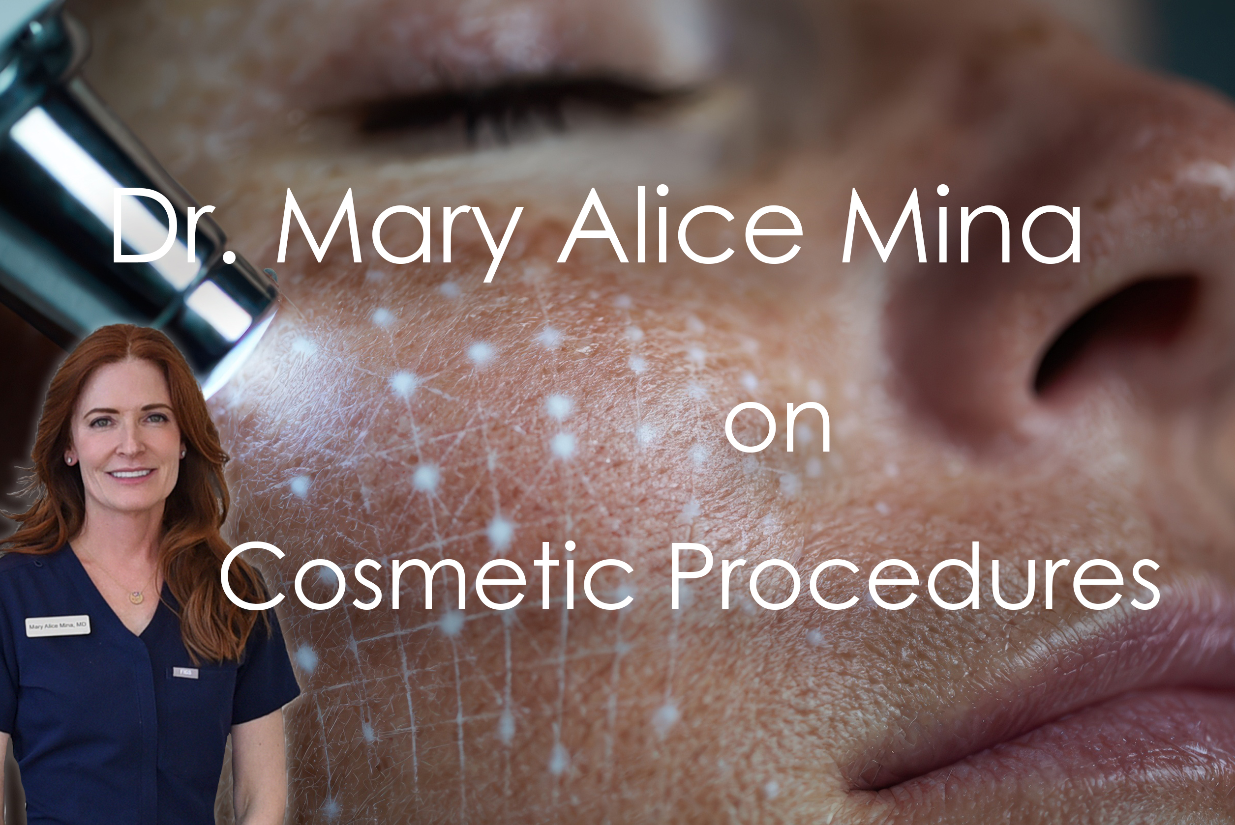 dr mary alice mina on cosmetic procedures